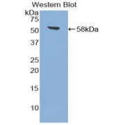 Western blot analysis of the recombinant protein.