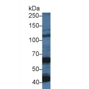 Western blot analysis of Pig Cerebrum lysate, using Human OAS1 Antibody (5 µg/ml) and HRP-conjugated Goat Anti-Rabbit antibody (<a href="https://www.abbexa.com/index.php?route=product/search&amp;search=abx400043" target="_blank">abx400043</a>, 0.2 µg/ml).