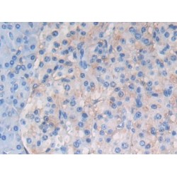 Activating Transcription Factor 6 (ATF6) Antibody