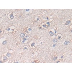 Activating Transcription Factor 6 (ATF6) Antibody