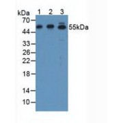 Western blot analysis of (1) Human SGC7901 Cells, (2) Human HeLa cells and (3) Rat Stomach Tissue).