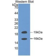 Western blot analysis of recombinant Human FGF2.