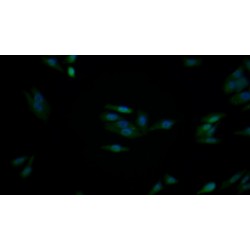 Fibroblast Growth Factor 2 (FGF2) Antibody