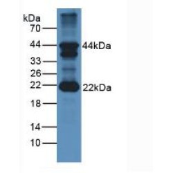 Follicle Stimulating Hormone Beta (FSHb) Antibody