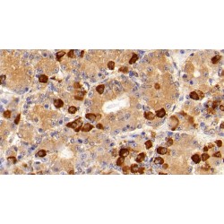 Follicle Stimulating Hormone Beta (FSHb) Antibody