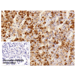 Follicle Stimulating Hormone Beta (FSHb) Antibody