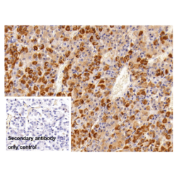 Follicle Stimulating Hormone Beta (FSHb) Antibody