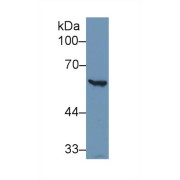 Western blot analysis of Human HeLa cell lysate, using Human G6PD Antibody (1 µg/ml) and HRP-conjugated Goat Anti-Rabbit antibody (<a href="https://www.abbexa.com/index.php?route=product/search&amp;search=abx400043" target="_blank">abx400043</a>, 0.2 µg/ml).