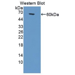 Glucose-6-Phosphate Dehydrogenase (G6PD) Antibody