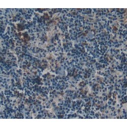 Glucose-6-Phosphate Dehydrogenase (G6PD) Antibody