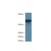Western blot analysis of Rat Colon lysate, using Rat G6PD Antibody (2 µg/ml) and HRP-conjugated Goat Anti-Rabbit antibody (<a href="https://www.abbexa.com/index.php?route=product/search&amp;search=abx400043" target="_blank">abx400043</a>, 0.2 µg/ml).