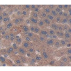 Glucose-6-Phosphate Dehydrogenase (G6PD) Antibody