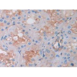 GRB2 Associated Binding Protein 1 (GAB1) Antibody