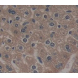 GRB2 Associated Binding Protein 1 (GAB1) Antibody