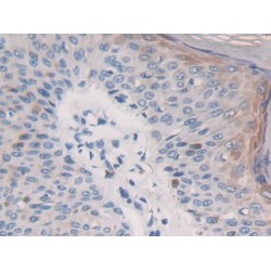 GRB2 Associated Binding Protein 3 (GAB3) Antibody