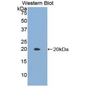 Western blot analysis of the recombinant protein.
