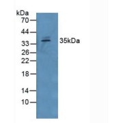 Western blot analysis of Human Serum.