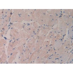 Growth Differentiation Factor 15 (GDF15) Antibody