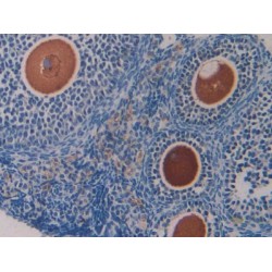 Growth Differentiation Factor 15 (GDF15) Antibody