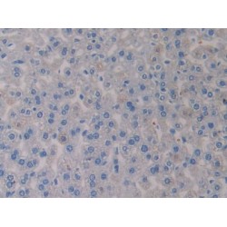 Growth Differentiation Factor 15 (GDF15) Antibody