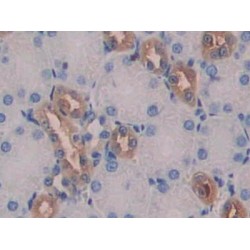 Growth Differentiation Factor 15 (GDF15) Antibody