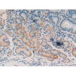 Heat Shock Transcription Factor 1 (HSF1) Antibody