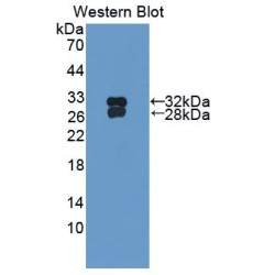 Heat Shock Transcription Factor 2 (HSF2) Antibody