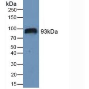 Western blot analysis of Human Serum.