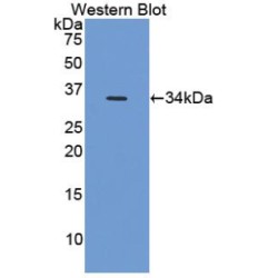 Hypoxia Inducible Factor 1 Alpha (HIF1a) Antibody