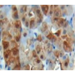 Hypoxia Inducible Factor 1 Alpha (HIF1a) Antibody