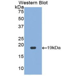 Hypoxia Inducible Factor 1 Alpha (HIF1a) Antibody