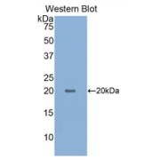 Western blot analysis of the recombinant protein.