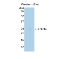 Endothelial PAS Domain-Containing Protein 1 (EPAS1) Antibody