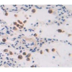 Endothelial PAS Domain-Containing Protein 1 (EPAS1) Antibody