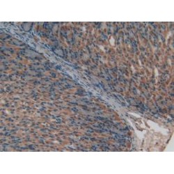 Endothelial PAS Domain-Containing Protein 1 (EPAS1) Antibody