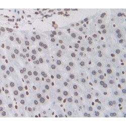 Endothelial PAS Domain-Containing Protein 1 (EPAS1) Antibody