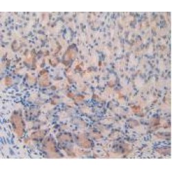 Interleukin 12 Receptor Beta 2 (IL12Rb2) Antibody