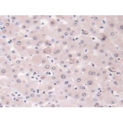 Large Multifunctional Peptidase 7 (LMP7) Antibody