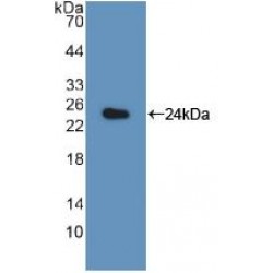Large Multifunctional Peptidase 7 (LMP7) Antibody