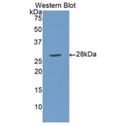 Western blot analysis of the recombinant protein.