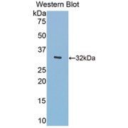 Western blot analysis of the recombinant protein.