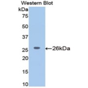 Western blot analysis of the recombinant protein.