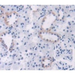 Protein O-GlcNAcase / MGEA5 (OGA) Antibody