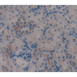 Protein O-GlcNAcase / MGEA5 (OGA) Antibody