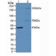 Western blot analysis of (1) Mouse Brain Tissue and (2) Mouse Testis Tissue.