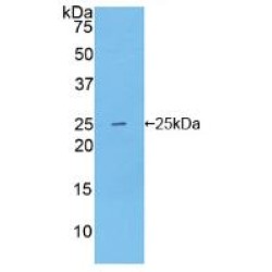 Nitric Oxide Synthase, Brain (NOS1) Antibody