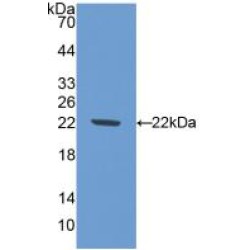 Nitric Oxide Synthase, Brain (NOS1) Antibody