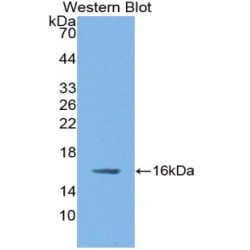 Nitric Oxide Synthase, Brain (NOS1) Antibody