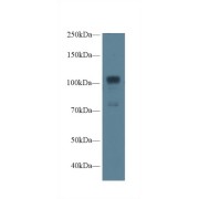 Western blot analysis of Human A549 cell lysate, using Rat NOS1 Antibody (1 µg/ml) and HRP-conjugated Goat Anti-Rabbit antibody (<a href="https://www.abbexa.com/index.php?route=product/search&amp;search=abx400043" target="_blank">abx400043</a>, 0.2 µg/ml).