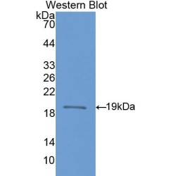 Nitric Oxide Synthase, Brain (NOS1) Antibody